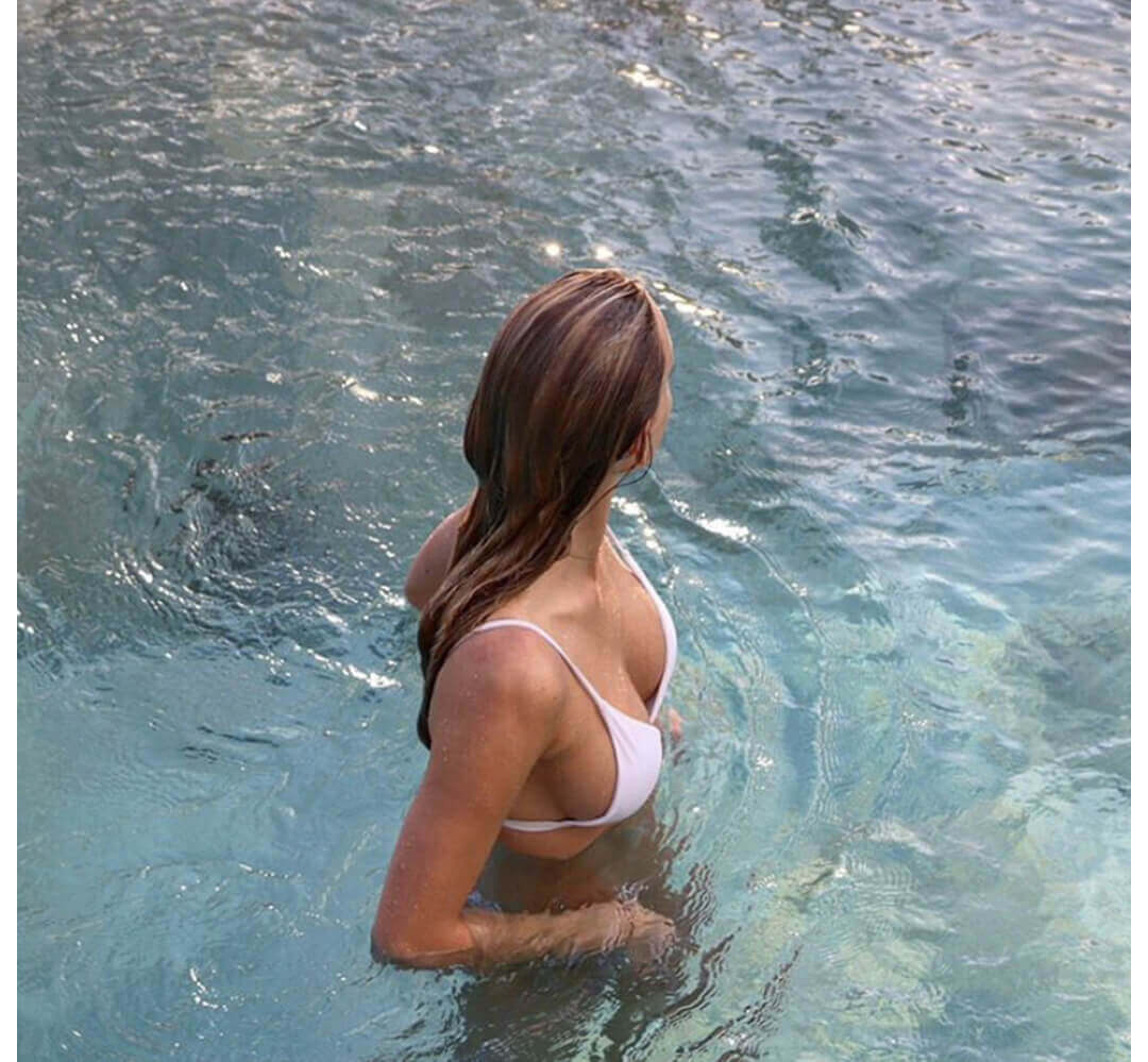 Breast Augmentation Houston After | Dr. Wijay