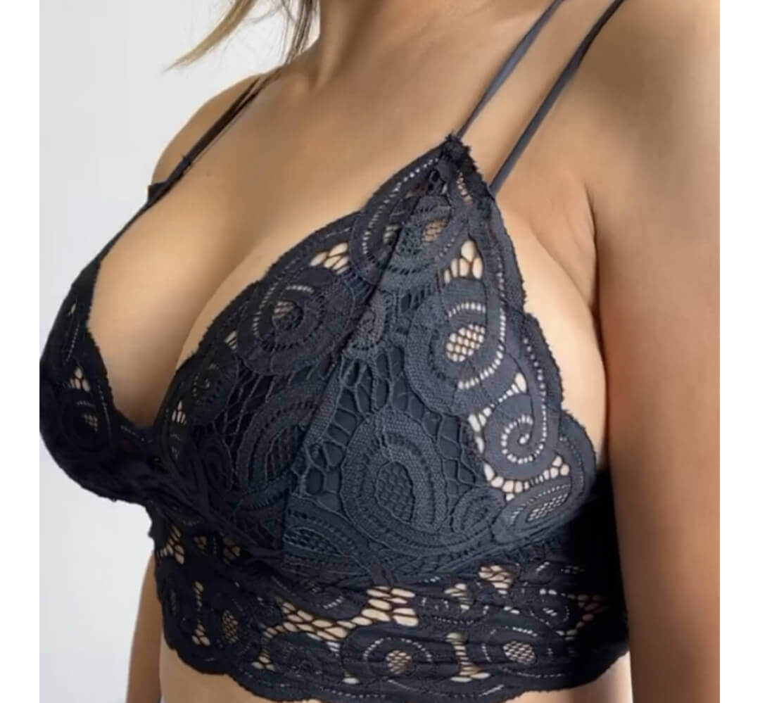 Breast Augmentation Houston After | Dr. Andry