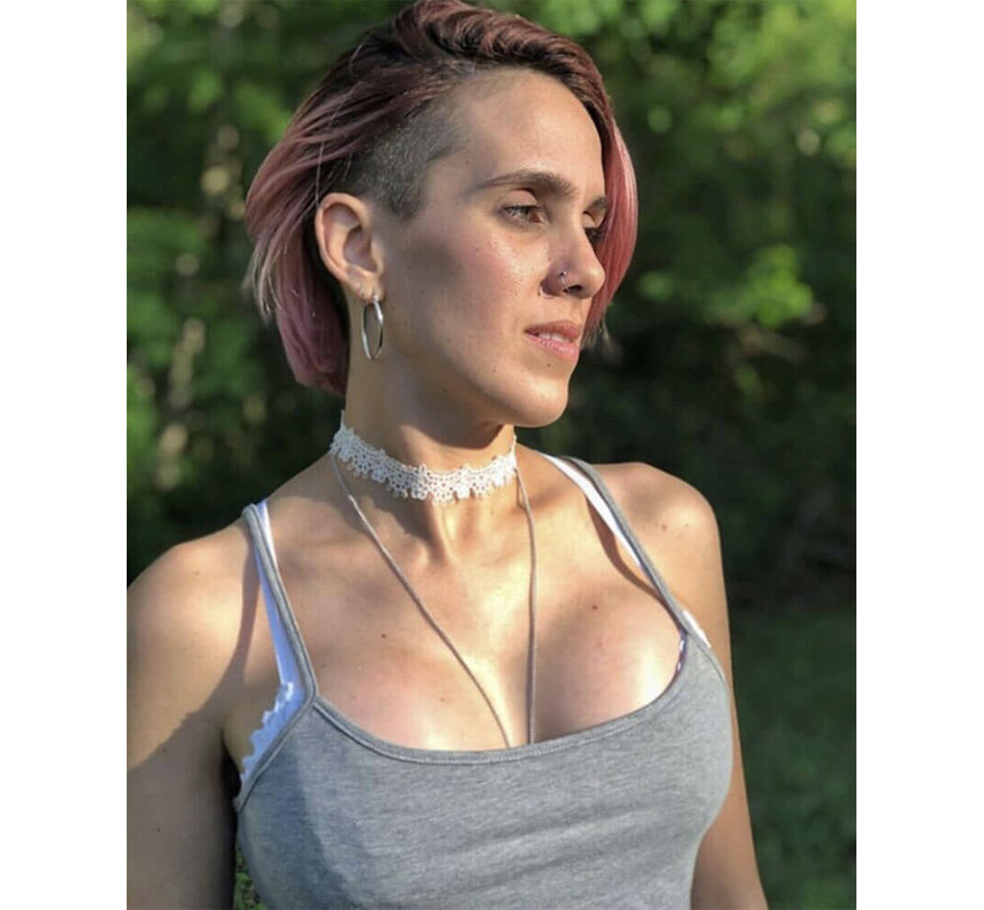 Breast Augmentation Houston After | Dr. Andry