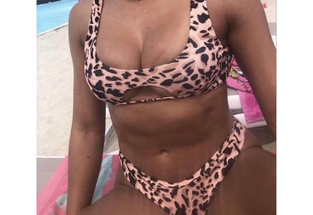 Breast Augmentation Houston